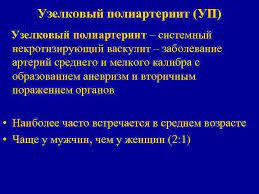 Это заболевание, называющееся (не вполне точно) до недавнего времени узелковым периартериитом, в действительности представляет собой. Uzelkovyj Poliarteriit Uzelkovyj Poliarteriit Up Uzelkovyj Poliarteriit