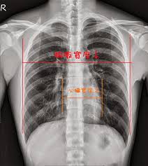 護理師聯合日記～＊