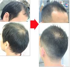 薄毛の人は坊主にすべき 女性100人に聞いた髪型のポイント hairs 本質的に根本から悩みを解決するために クリニックや育毛剤などの真実を伝えるメディア 薄毛 はげ 髪型 かっこいい髪型