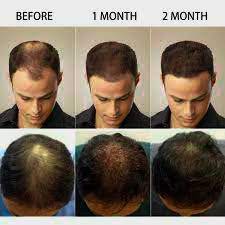 Many people yearn for long, luscious hair. What Oil Is Good For Hair Growth