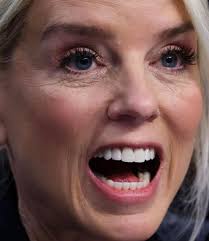 We Loathe SuSSSan, Big☢️Ted & Murdoch