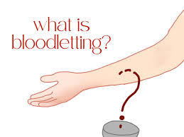 Taking a look into the past and present of medicine's ancient “cure-all” –  Eastside