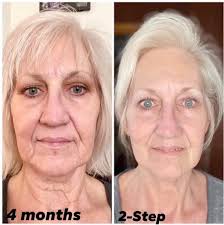 The fountain of youth collection is back in stock! ⛲️❤️  https://pomifera.com/MemberToolsDotNet/ShoppingCartV4/MainCartv4.aspx?MG=7  This is the system that has completely changed my skin, improved my redness  and rosacea, and healed my itchy, raw face.