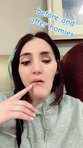 Reconstructive Surgery After Car Accident