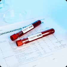 Si sottolinea che piccoli spostamenti dai valori normali spesso non sono significativi e non devono destare preoccupazioni, ma ovviamente nessuno meglio del medico potrà valutare il referto nel contesto generale dello specifico paziente. Depistare Anticorpi Covid 19 Profil Imunologic Sars Cov 2