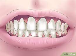 Our doctors at nova perio specialists treat gum disease in leesburg, va to help prevent tooth and bone loss. 3 Ways To Reverse Dental Bone Loss Wikihow