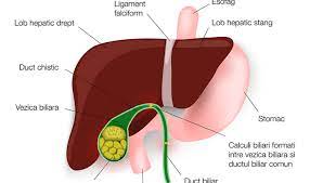 Colica biliara sau criza de fiere afectează cu preponderență persoanele. Litiaza Biliara Reginamaria Ro