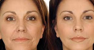 Voici Comment Utiliser De L Huile D Olive Pour Attenuer Les Rides Sante Beaute Les Rides Recette Beaute