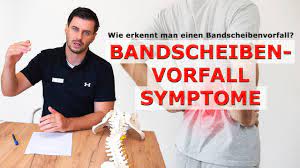 Wie Erkennt Man Einen Bandscheibenvorfall Askcorpusmotum Youtube
