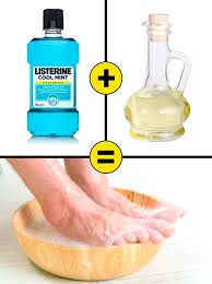 Submerge both feet and move around slowly. 10 Home Remedies To Remove Cracked Heels And Get Beautiful Feet