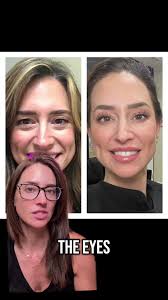 Wolfe Eye Clinic Marshalltown Iowa