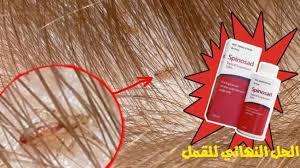 تعرف على أكثر من 10 اسماء ادويه علاج قمل الشعر Mysit