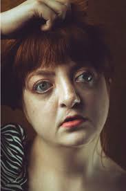 Rise in hate crime against people with disfigurements