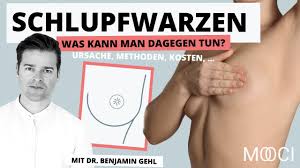 Dazu kommt, daß beide brüste seit 1 jahr weh tun. Schlupfwarzen Kosten Risiken Behandlung Mooci