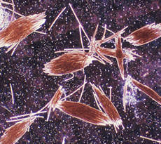 Image result for Erythrococca trichogyne