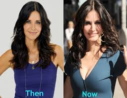 Now, cosmetic and reconstructive procedures are quite common, and many do not even require invasive measures. Courteney Cox Plastic Surgery Before And After A Photo On Flickriver