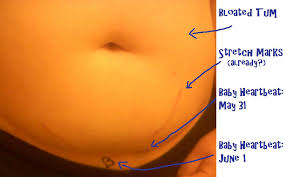 Switch on the device from the power button located right on the center of the doppler. Plus Size Mamas Using An At Home Doppler Baby Birdet