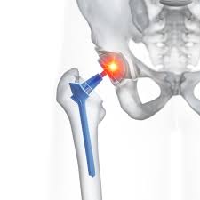 Resultado de imagen para fisioterapia