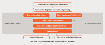 Periodontal Treatment Flow Chart 2019