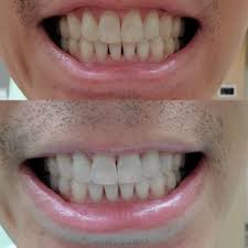 AHN DENTAL SPECIALISTS