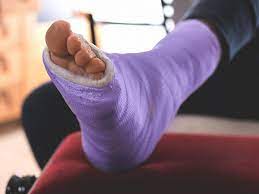 Even if the weight reduction is a medical diagnosis. Broken Foot Symptoms What To Expect