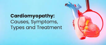Image result for Cardiomyopathy