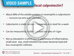 「videos/load/recent ~gastrointestinal」的圖片搜尋結果