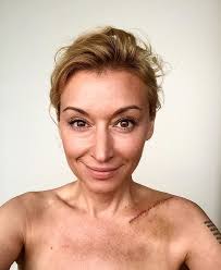Martyna wojciechowska jako podróżniczka wielokrotnie spotyka się z niebezpiecznymi sytuacjami. Martyna Wojciechowska Miala Powazny Wypadek Motocyklowy Zdjecie Gazeta Pomorska