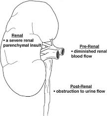 Kidney (renal) failure (acute or chronic) occurs when the kidneys no longer function well and the end stage of kidney failure. Renal Failure Radiology Key