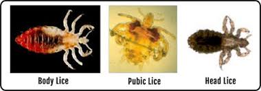 Image result for pubic lice symptoms