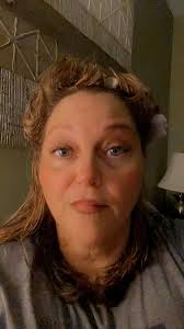 Alternative skin care for puffy face after being glutened