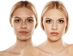 Implantree Dental & Aesthetic Clinic Dubai