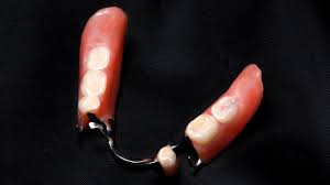 This can help clean the spaces between the fake teeth where plaque and tobacco stains may reside. How Do You Get Stains Out Of Partial Dentures