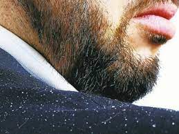 Now that is a long time to have something making you scratch and notice every single movement your face and neck make. 4 Definitive Hacks To Get Rid Of Your Beard Dandruff The Itchy Flaky Skin Within A Week