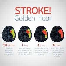 Those who survive a stroke can. Novago Raises 8 8m To Progress Regenerative Stroke Treatment