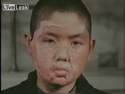 Maybe you would like to learn more about one of these? ã‚«ãƒ©ãƒ¼åºƒå³¶åŽŸçˆ†æŠ•ä¸‹å¾Œã®ç¾åœ°æ°' Hiroshima People After Atomic Bomb Dropped Youtube