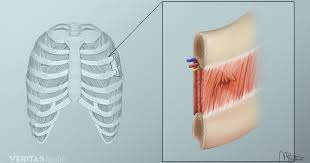 Pin On Autoimmune And Pain
