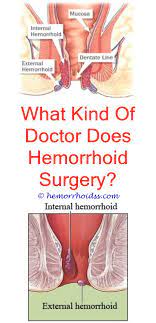 What To Do If You Have Hemorrhoids Hemorrhoids Hemorrhoids Treatment Bleeding Hemorrhoids