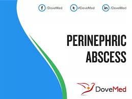 Image result for Perinephric Abscess