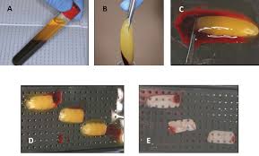 Sam sposób przygotowania membrany prf jest niezwykle prosty i polega na pobraniu. Characterization Of Leukocyte Platelet Rich Fibrin A Novel Biomaterial Protocol