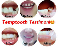 Walau kini gigi palsu lepasan mudah didapat dan harganya terjangkau, tapi banyak orang yang 4. Gigi Palsu Gigi Temptooth Boleh Kunyah Makanan False Teeth False Shopee Malaysia