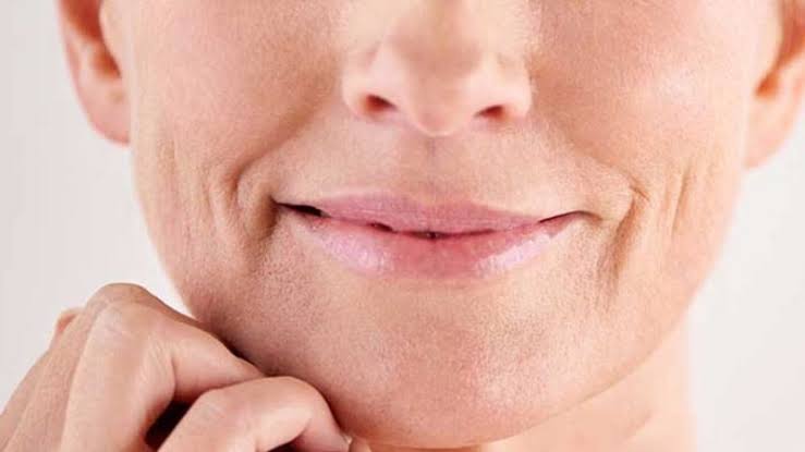 Lão hóa ở khóe miệng: Hướng dẫn chuyên sâu giúp phụ nữ trên 40 tuổi ngăn