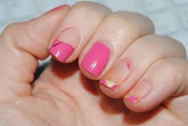 Nail fungus treatment comparison emoninail omiera nonyx fungi stellnaturals clear nail zane there are a lot of nail fungus treatments on the market so you need to be careful that you don't fall there are many symptoms of nail fungus. Acrylic Nail Health Risks Nail Gel Risks And Detrimental Effects