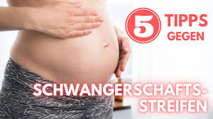 Es gibt noch keine möglichkeiten, die dehnungsstreifen nach einer schwangerschaft vollständig zu entfernen. Schwangerschaftsstreifen Vorbeugen Vermeiden 5 Tipps