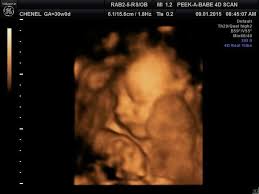 Pin On Pregnancy