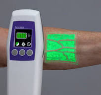 Near-infrared vein finder - AV500 - AccuVein - venipuncture ...
