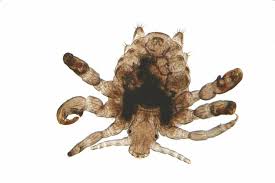 Image result for pubic lice symptoms