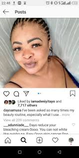 Fans To Dayo Amusa: "You Are Bleaching Too Much"