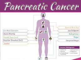 Later there may be weakness, jaundice, weight loss. 7 Early Warning Signs Of Pancreatic Cancer 99 Health Ideas