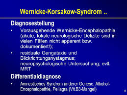 Darüber hinaus treten sie bei nichtorganischen psychischen störungen auf, vor allem bei der depression. 1 Vortrag Mit Fallbeispielen Alkoholfolgeerkrankungen Referent Thorsten Montanus Facharzt F U R Nervenheilkunde Ppt Herunterladen